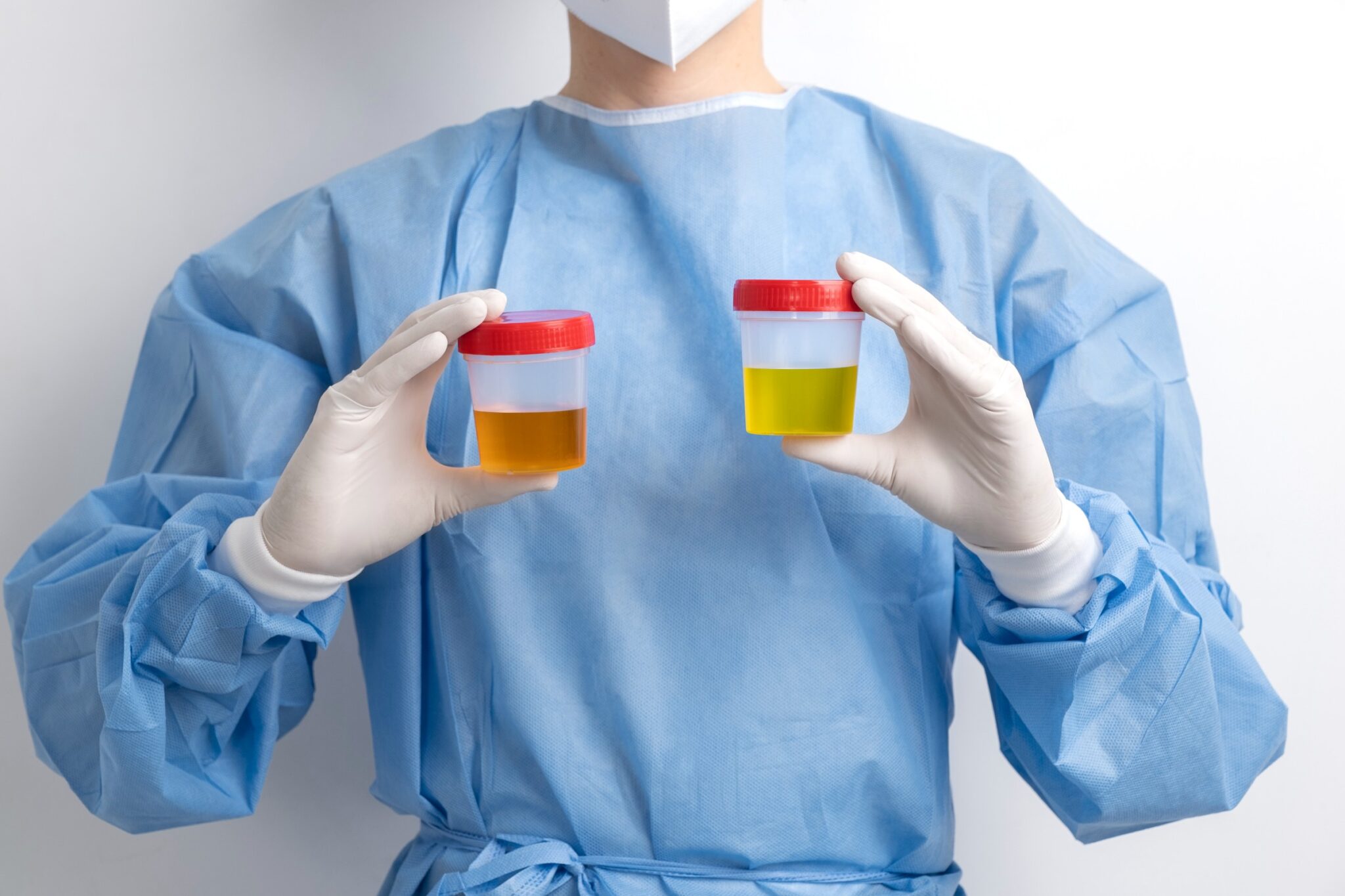 lab-doctor-performing-medical-exam-urine (1)